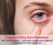 Types of Dry Eye Disease