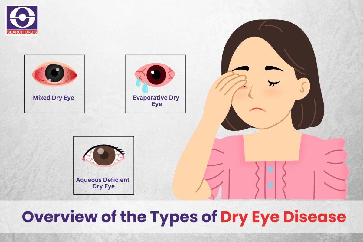 Types of Dry Eye Disease