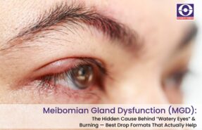 Meibomian Gland Dysfunction