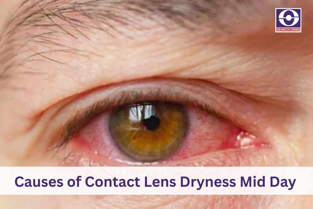Contact Lens Discomfort