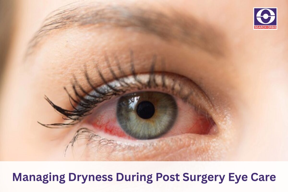 Post Surgery Eye Care
