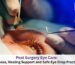 Post Surgery Eye Care
