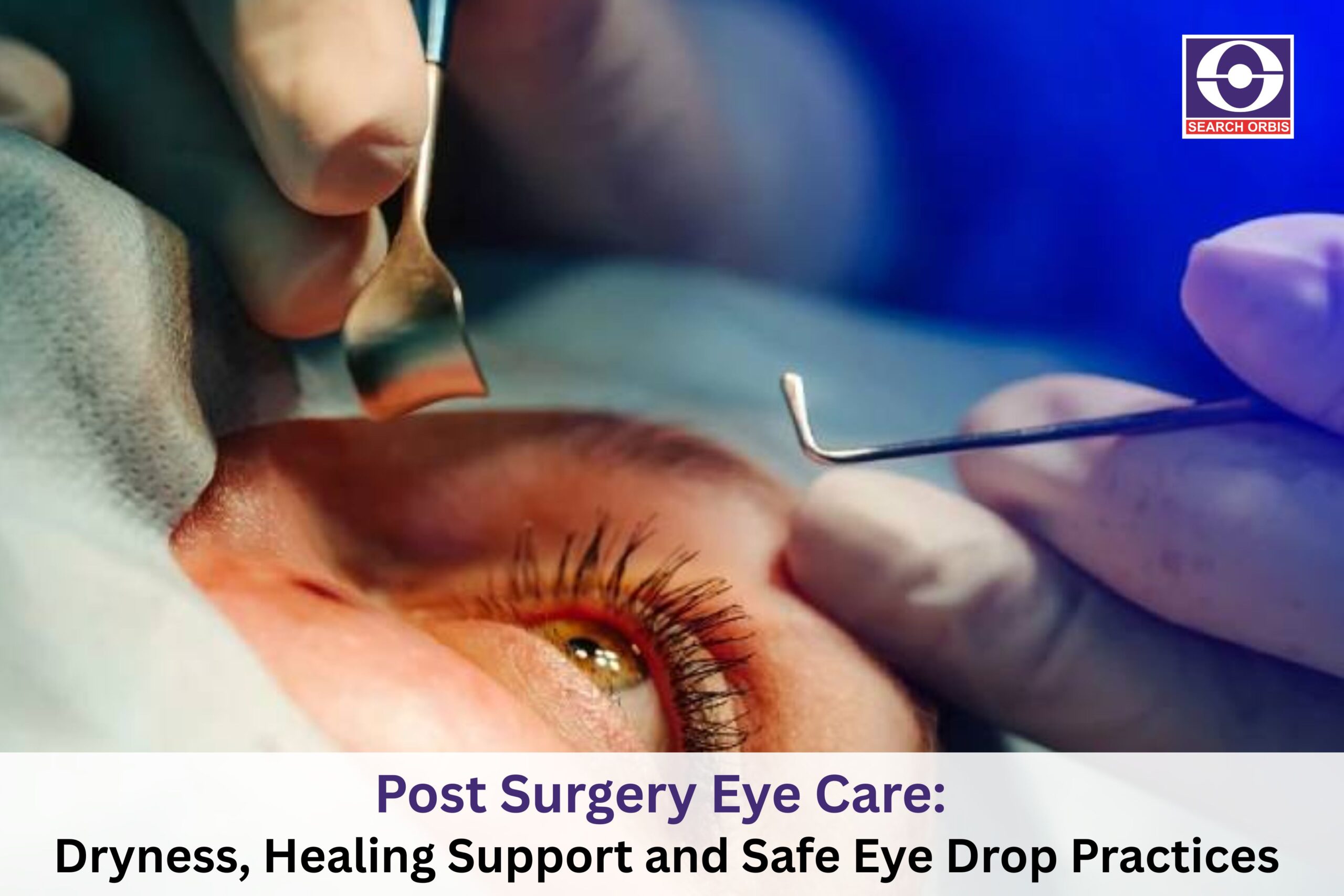 Post Surgery Eye Care