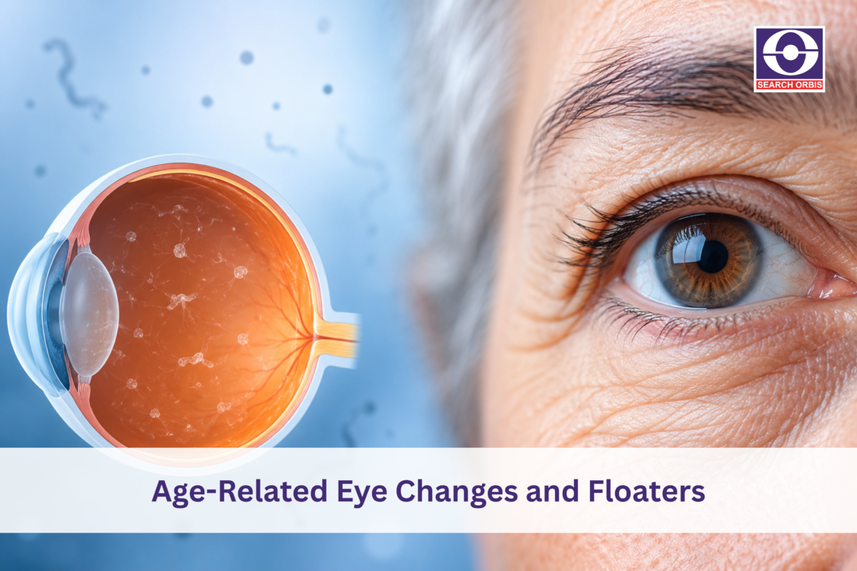 Illustration showing age-related eye changes and vitreous floaters alongside a close-up of an older adult's eye.
